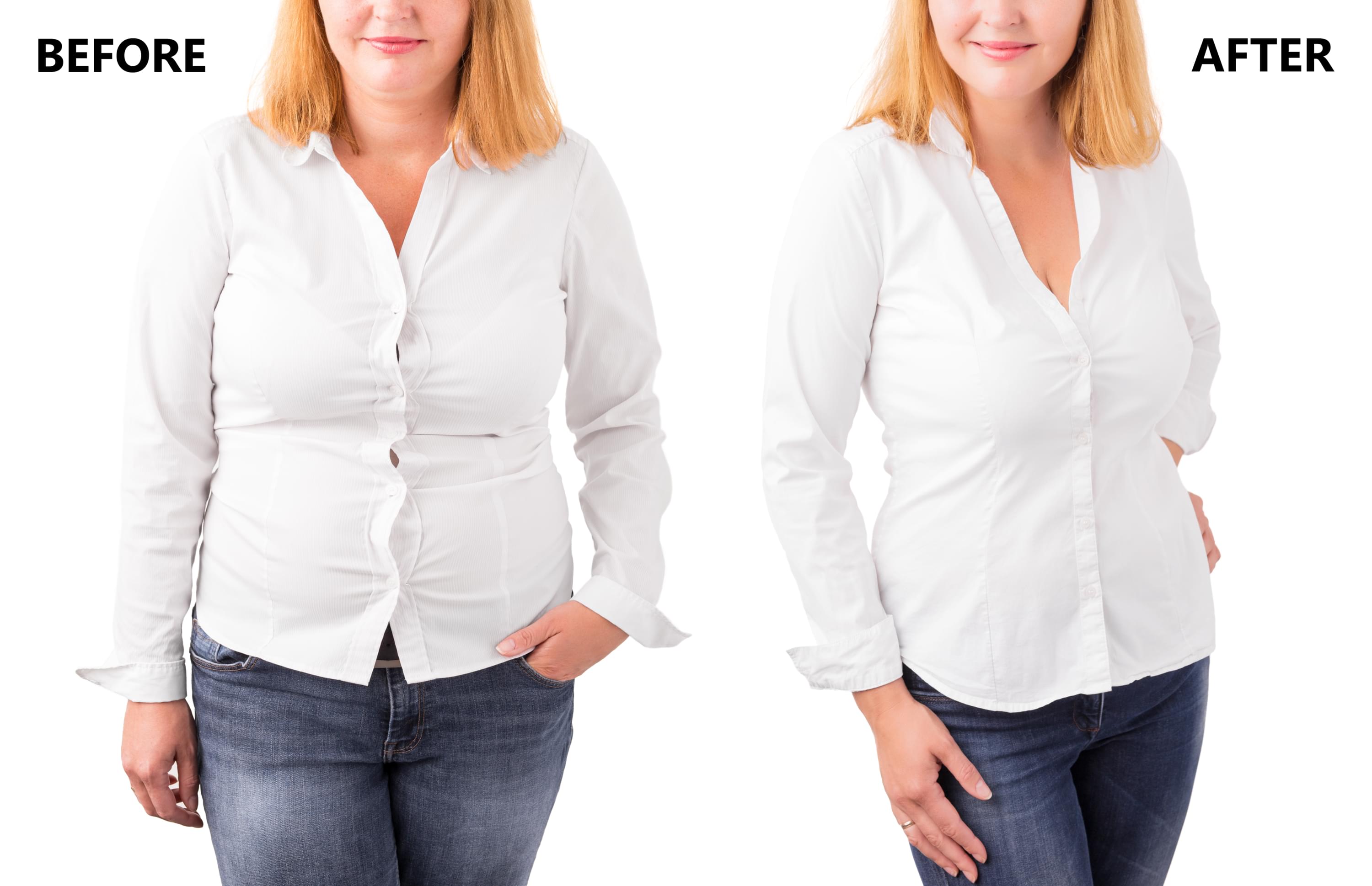 Woman before/after weight loss image