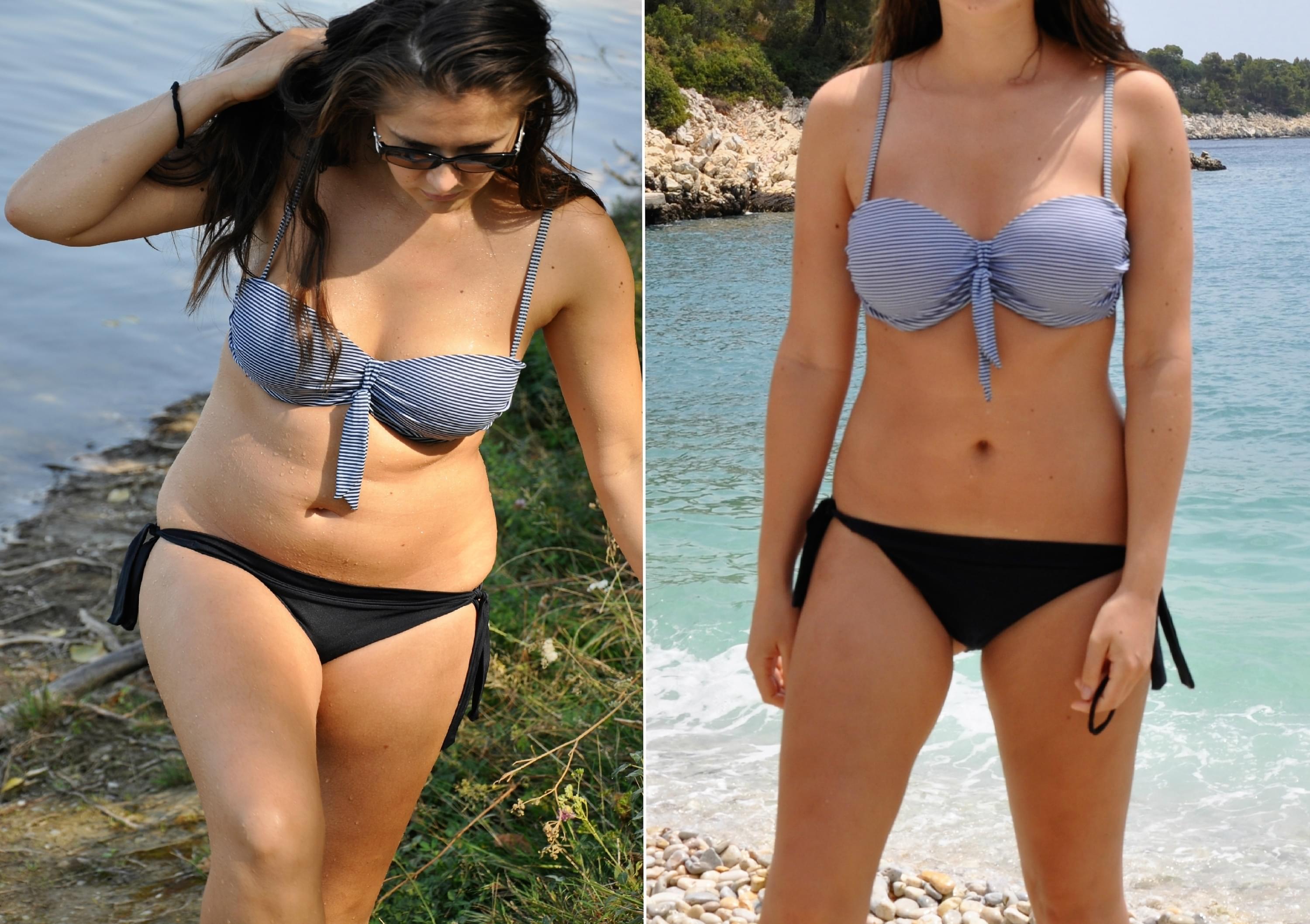 Woman before/after weightloss in bikini
